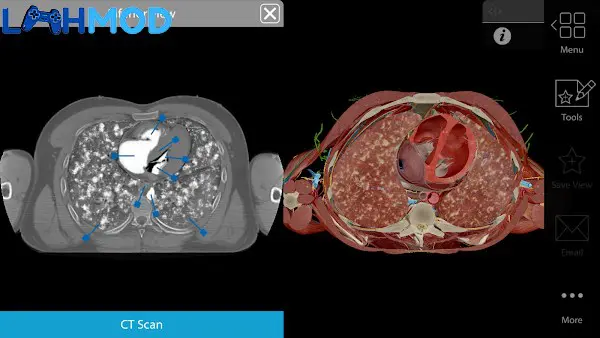 Ảnh 2 của Physiology & Pathology MOD APK 1.1.06 (Trả tiền) Giao diện hiển thị các bài giảng y học trong Physiology & Pathology MOD