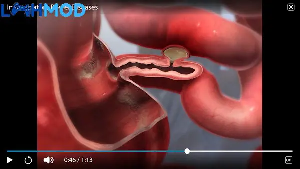 Ảnh 4 của Physiology & Pathology MOD APK 1.1.06 (Trả tiền) Người dùng đang tương tác với ứng dụng Physiology & Pathology MOD trên thiết bị di động